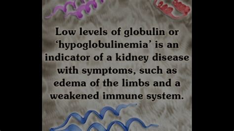 beta 1 globulin low|Important Information About Low Globulin All Must Be Aware Of.